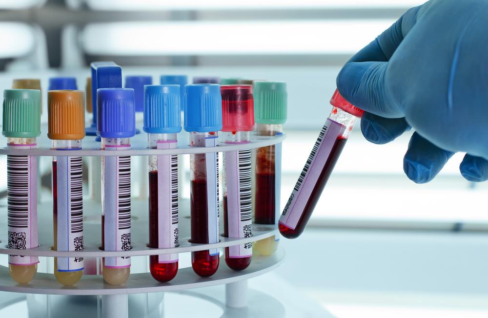 Lab test tubes for Integrative cancer support